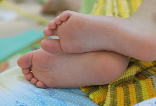 哺乳期有脚气需要注意脚部卫生